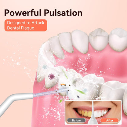 Irrigador Bucal Eléctrico Portátil Inalámbrico - Limpieza Dental Con Agua a Presión, Resistente Al Agua IPX7, Ideal Para Casa Y Viaje